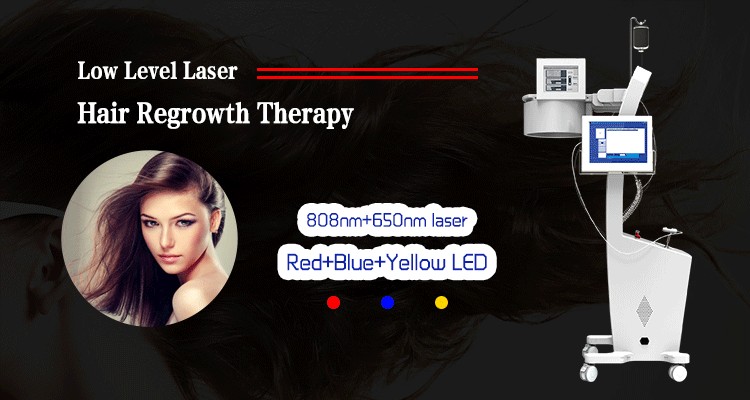 laser hair loss treatment  (1)