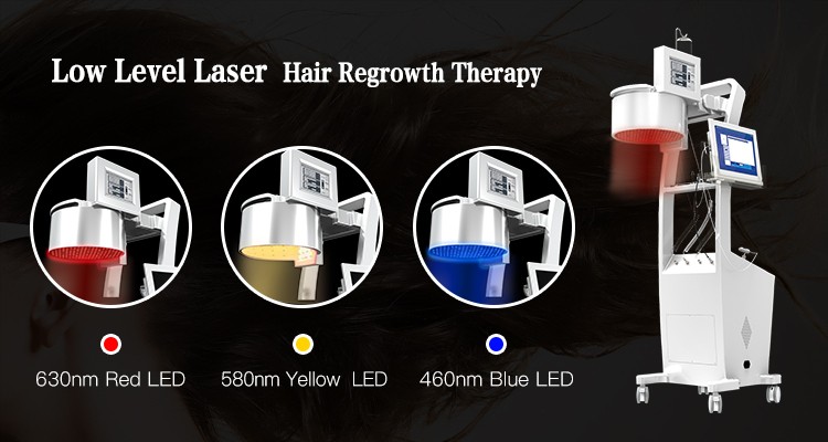 laser hair loss treatment  (2)
