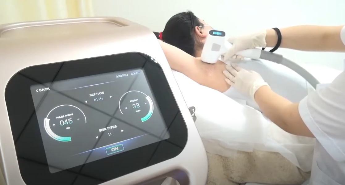 diode laser hair removal machine (5)